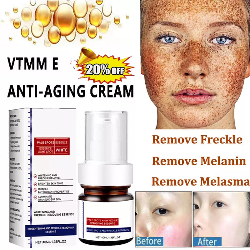 Vitamin C Whitening Freckles Face Cream Remove Melasma Dark Spots Lighten Melanin BUY 1 GET 1 FREE 2 PACK