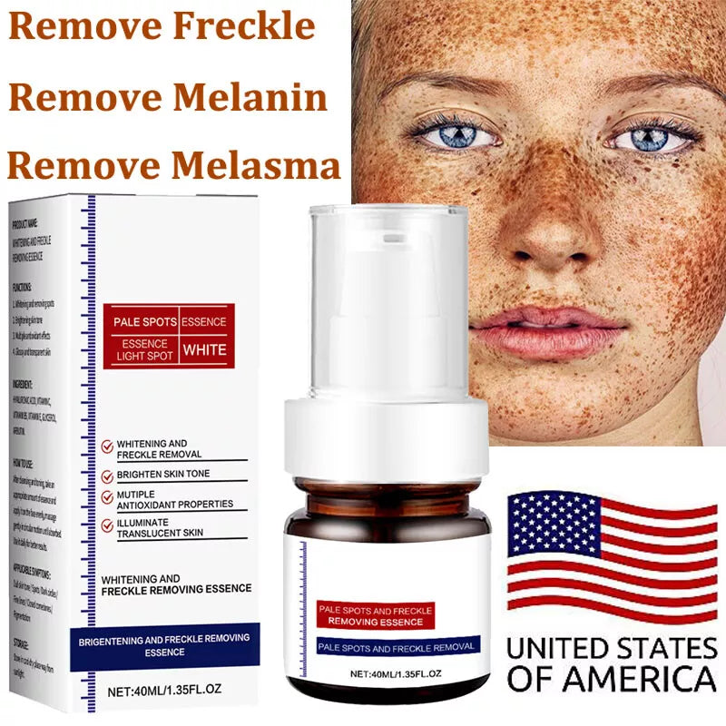 Vitamin C Whitening Freckles Face Cream Remove Melasma Dark Spots Lighten Melanin BUY 1 GET 1 FREE 2 PACK