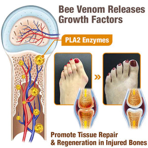 New Zealand Bee Venom Joint and Bone Healing Cream