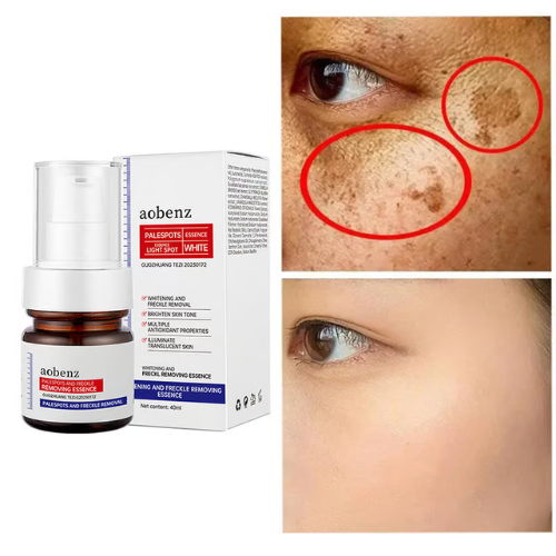 Vitamin C Whitening Freckles Face Cream Remove Melasma Dark Spots Lighten Melanin