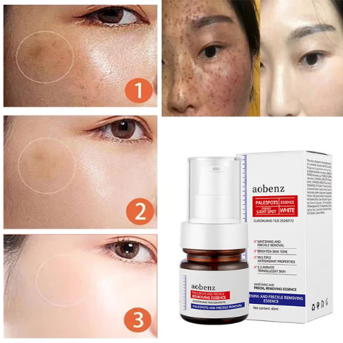 Vitamin C Whitening Freckles Face Cream Remove Melasma Dark Spots Lighten Melanin BUY 1 GET 1 FREE 2 PACK