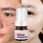 Vitamin C Whitening Freckles Face Cream Remove Melasma Dark Spots Lighten Melanin BUY 1 GET 1 FREE 2 PACK